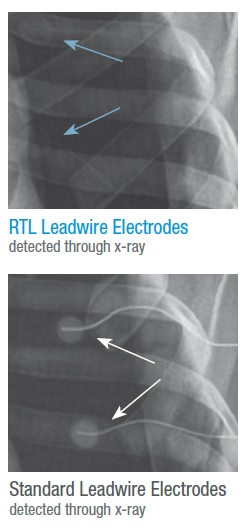 Neotrode II RTL 1741C-003